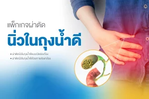 แพ็กเกจผ่าตัดนิ่วในถุงน้ำดี 99,000 – 165,000 บาท