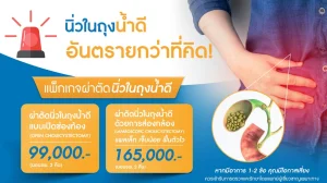 แพ็กเกจผ่าตัดนิ่วในถุงน้ำดี 99,000 – 165,000 บาท