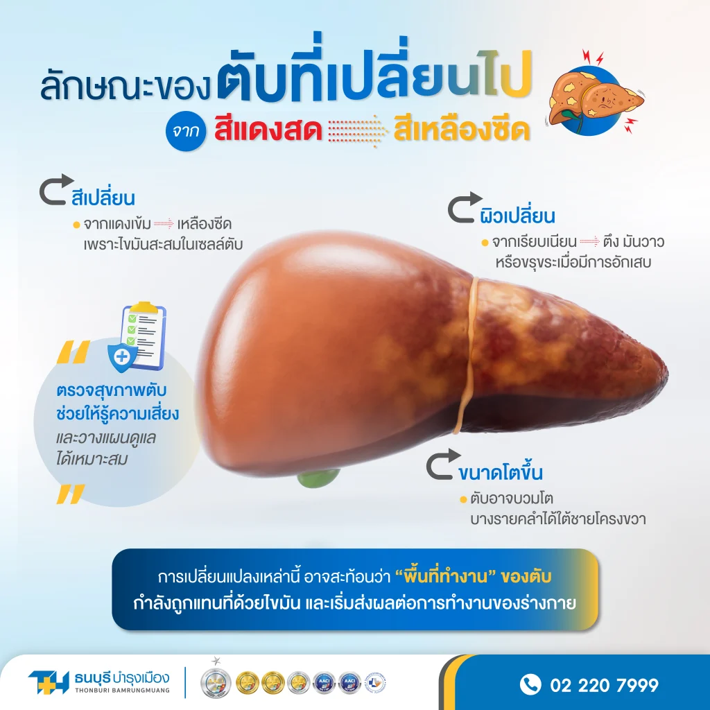 ลักษณะตับปกติและตับที่มีไขมันพอก