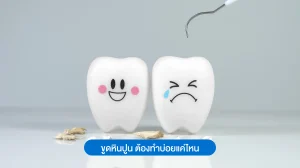 ขูดหินปูน ต้องทำบ่อยแค่ไหน