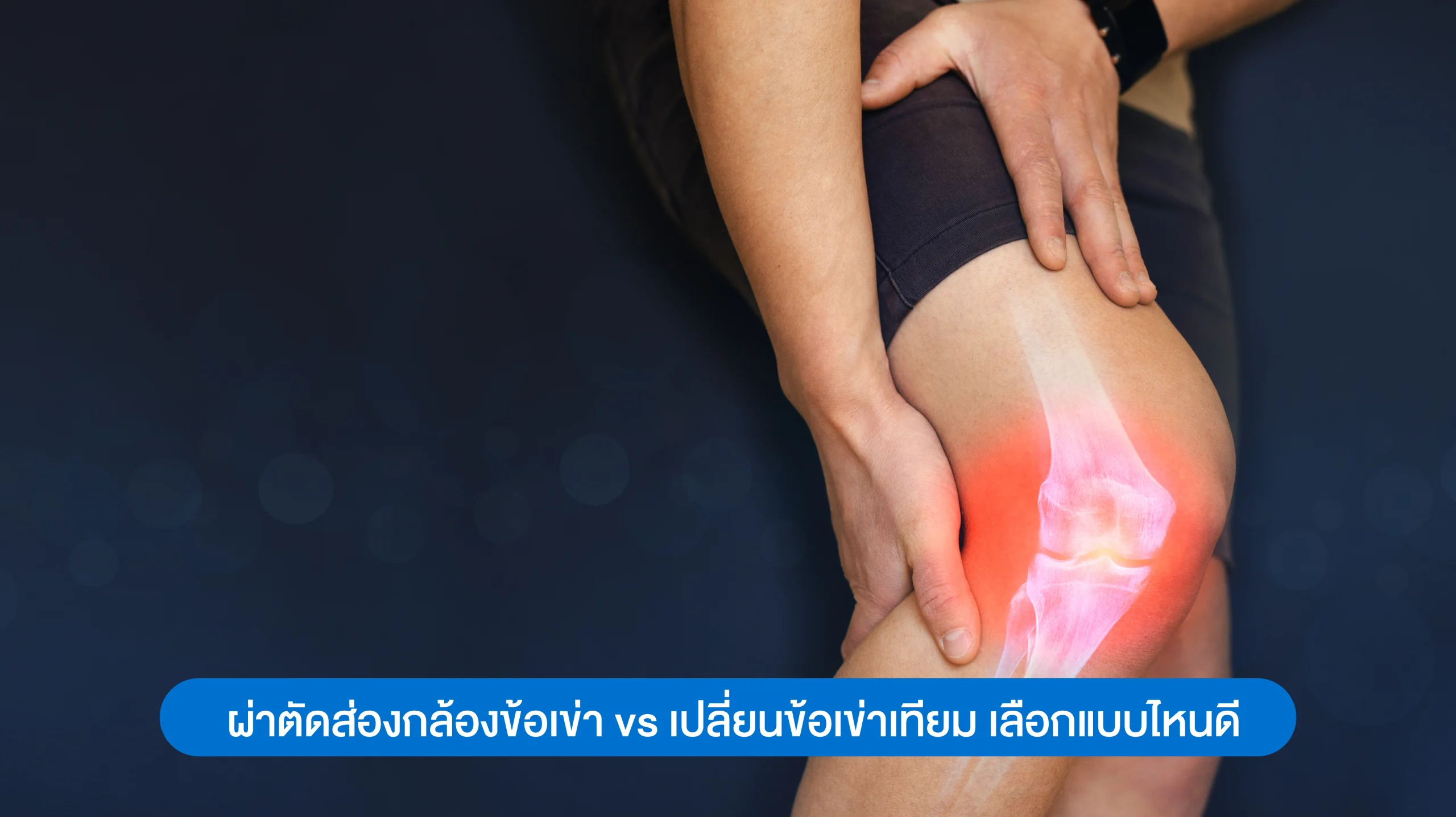 ผ่าตัดส่องกล้องข้อเข่า vs เปลี่ยนข้อเข่าเทียม เลือกแบบไหนด