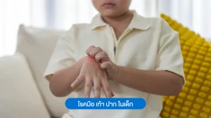โรคมือ เท้า ปาก ในเด็ก