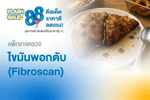 Flash Sale ตรวจไขมันพอกตับ FibroScan