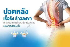 แพ็กเกจผ่าตัดกระดูกสันหลังผ่านกล้อง โรงพยาบาลธนบุรี บำรุงเมือง