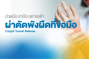 แพ็กเกจผ่าตัดพังผืดกดทับเส้นประสาทข้อมือ