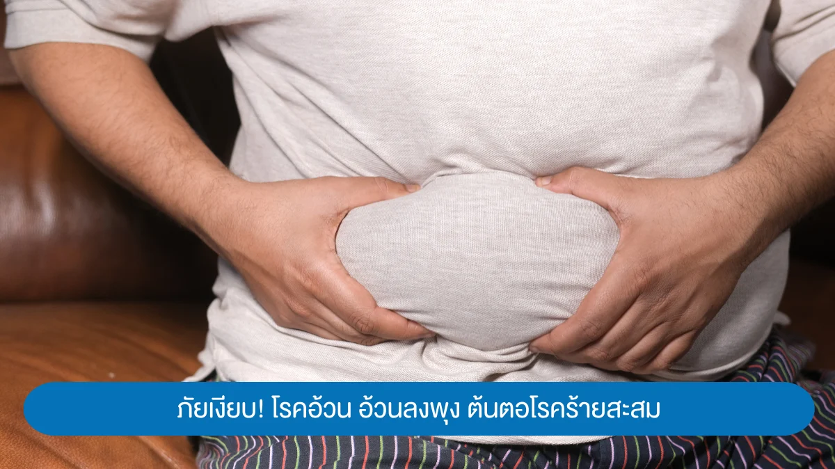 ภัยเงียบ ! โรคอ้วน อ้วนลงพุง เสี่ยงสารพัดโรคร้าย
