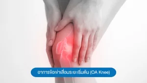 อาการข้อเข่าเสื่อมระยะเริ่มต้น