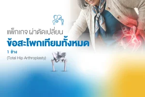 แพ็กเกจผ่าตัดเปลี่ยน-ข้อสะโพกเทียมทั้งหมด